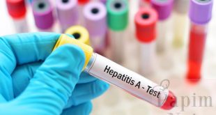 Hepatit A Hastalığı Nedir, Rehabilitasyon Teknikleri Nelerdir?