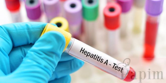 Hepatit A Hastalığı Nedir, Rehabilitasyon Teknikleri Nelerdir?